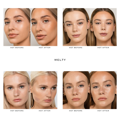 MELTY